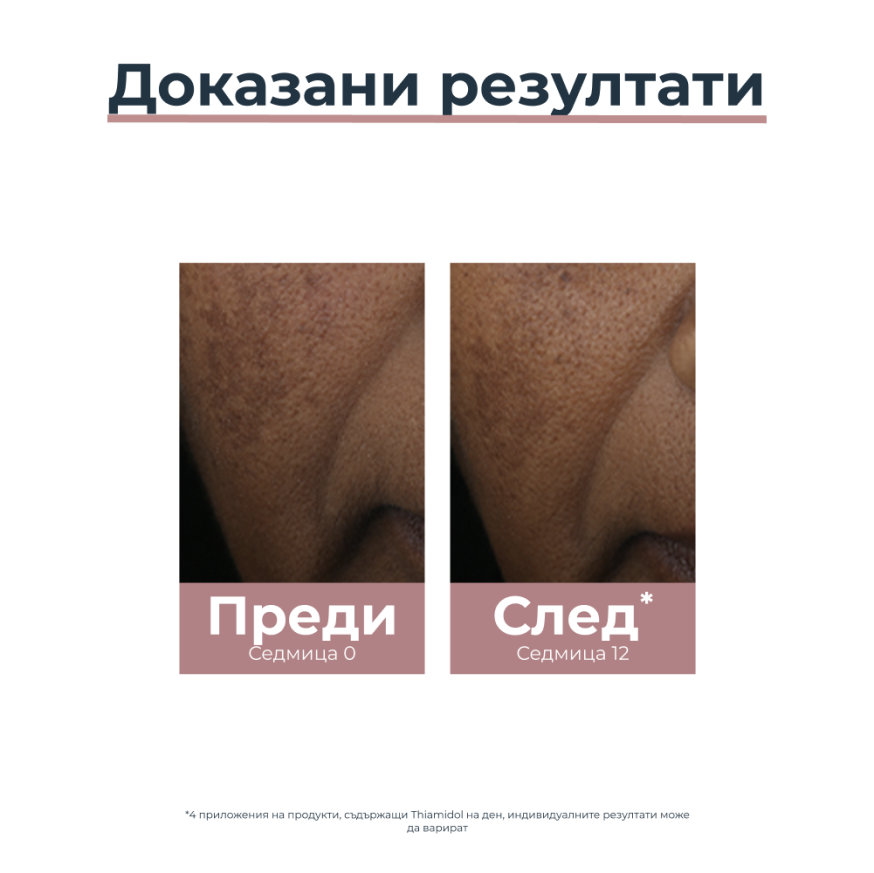 Eucerin ANTI-PIGMENT Спот-коректор, 5мл