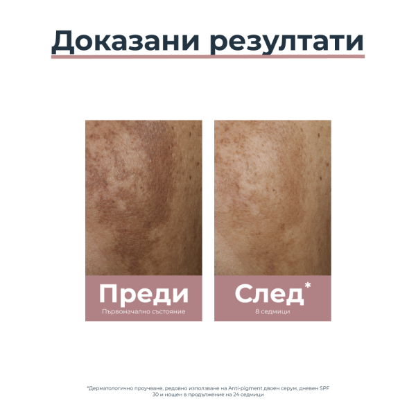 Eucerin ANTI-PIGMENT Нощен крем, 50мл
